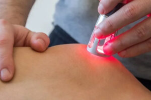 Laser therapy treatment at Forest Hill Chiropractic and Massage Clinic in Toronto